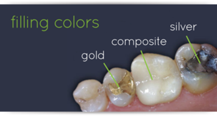types of fillings