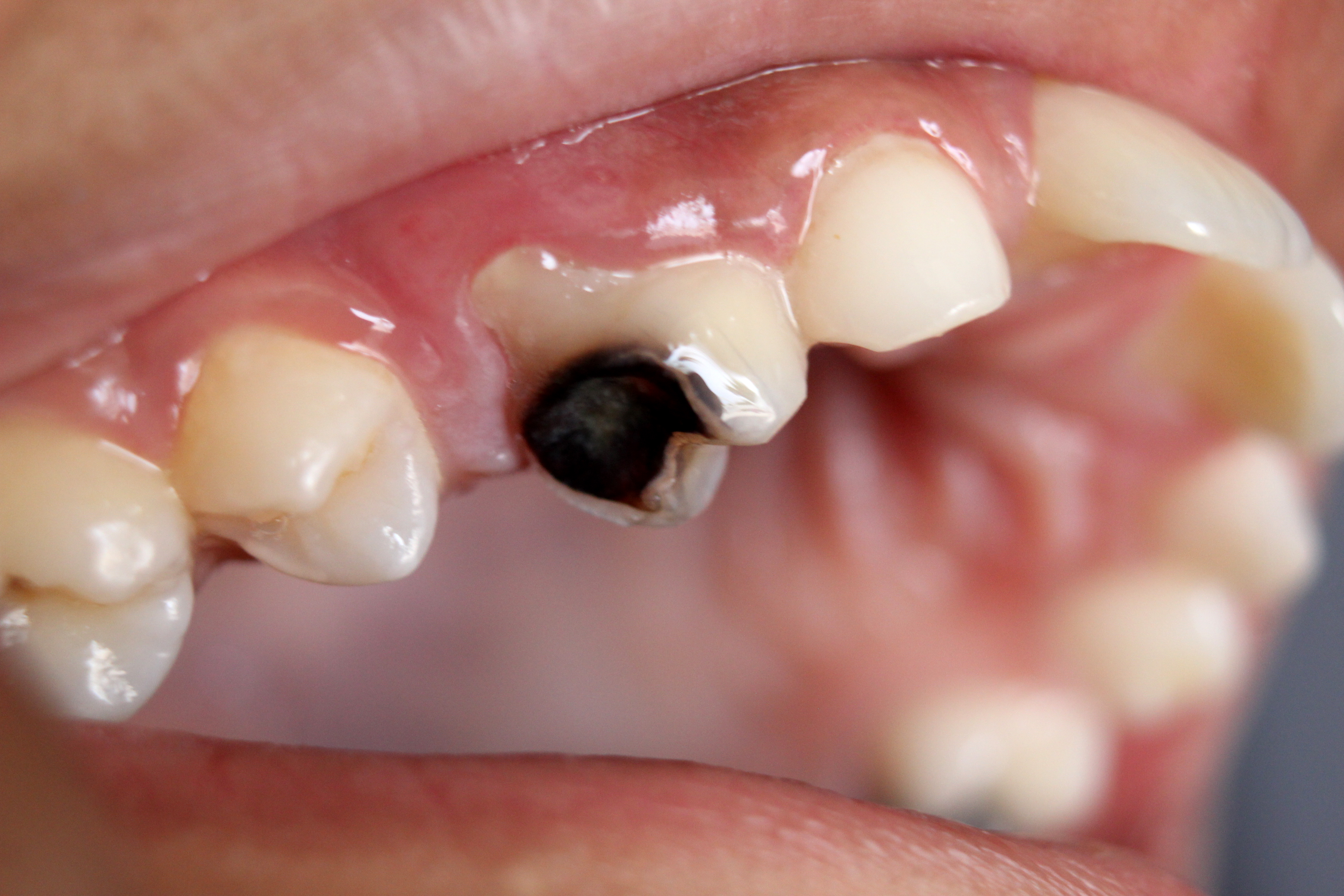 How The Lymphatic System Impacts Dental Health | Comfort Care Family Dental P.C. How The Lymphatic System Impacts Dental Health | Comfort Care Family Dental P.C.