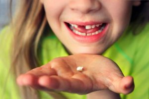 Child losing teeth