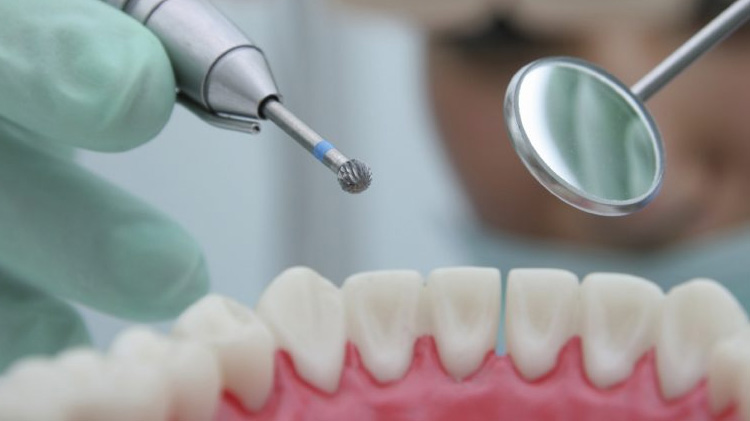 Dental Drill used on Dental Implants
