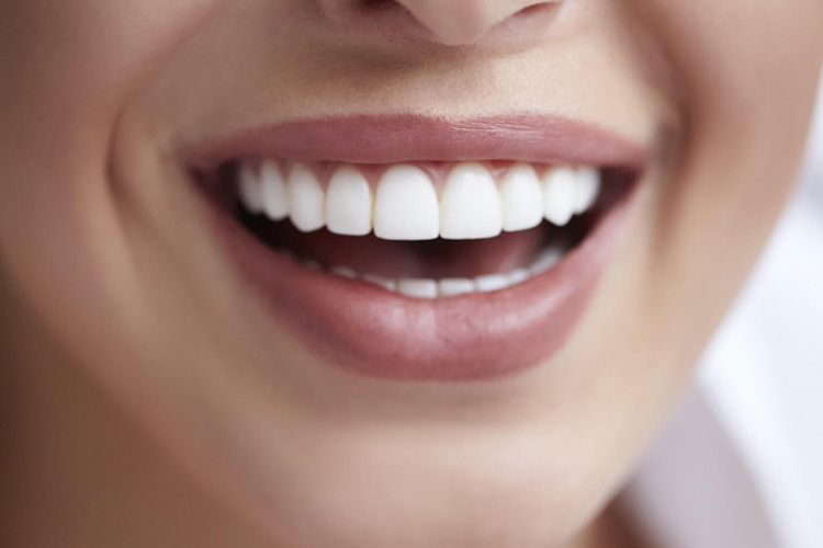 Do Porcelain Veneers Protect Your Teeth