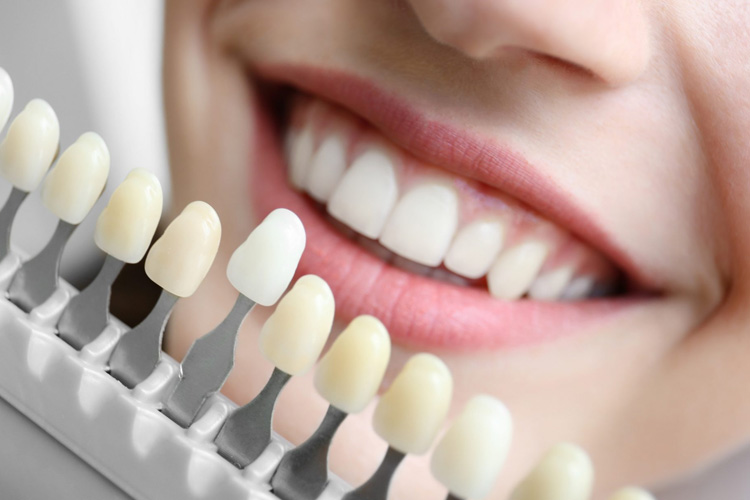 Top 7 Reasons To Choose Dental Implants