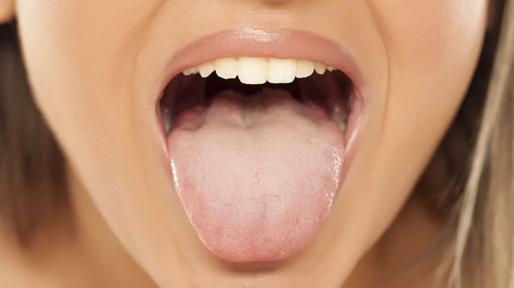 Can Your Tongue Tell About Your Hygiene